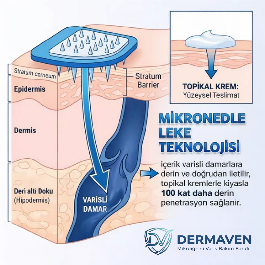 DermaVen Mikroiğneli Varis Bakım Bandı
